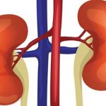 Renal replacement therapies for patient with end-stage renal disease